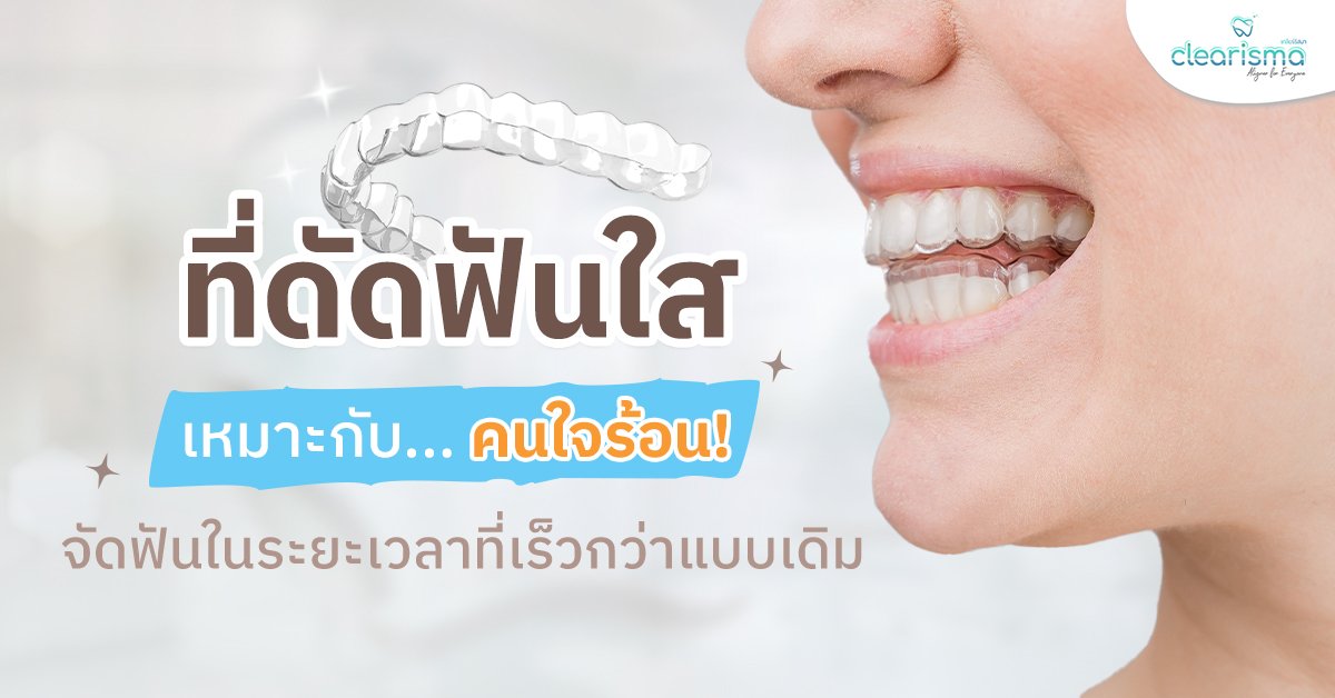 ที่ดัดฟันใส เหมาะกับคนใจร้อน เหตุผลที่คุณอาจยิ้มได้เร็วกว่าแบบอื่น