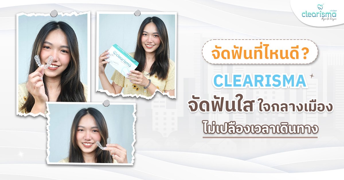 จัดฟันที่ไหนดี CLEARISMA จัดฟันใสใจกลางเมือง ไม่เปลืองเวลาเดินทาง
