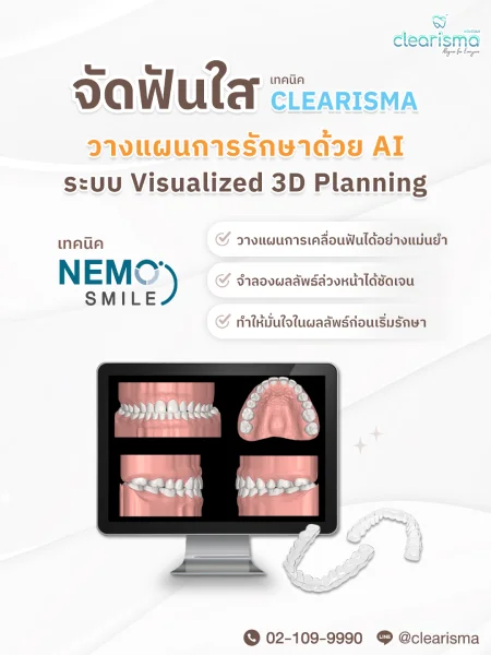 จัดฟันใส วางแผนด้วยAI