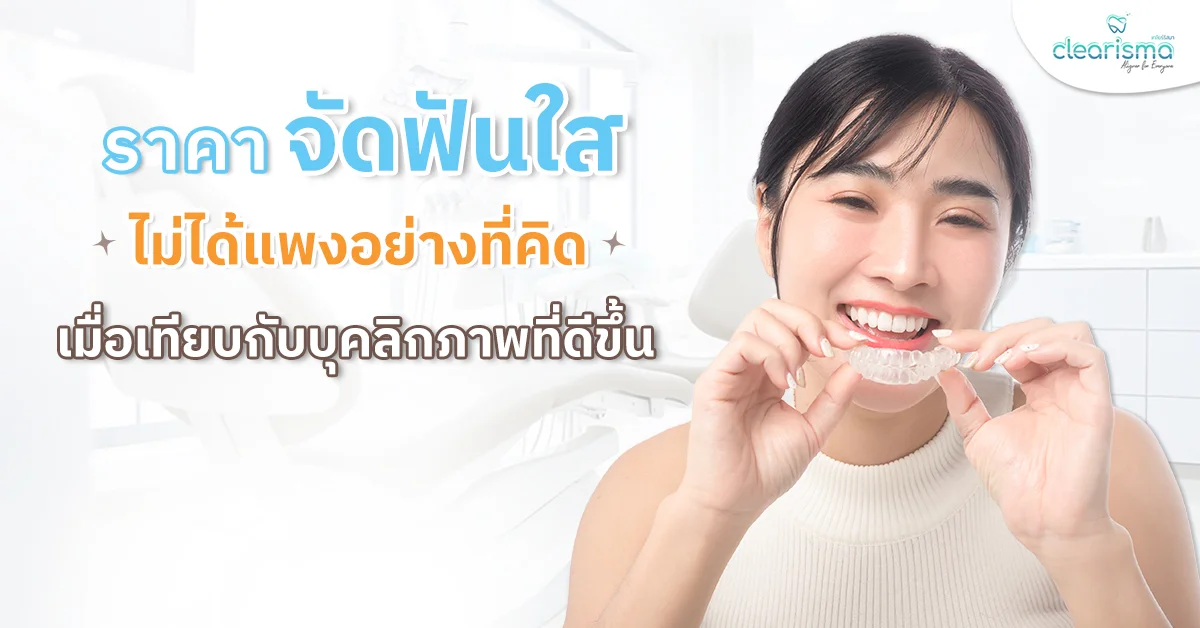 ราคาจัดฟันใส ไม่ได้แพงอย่างที่คิด