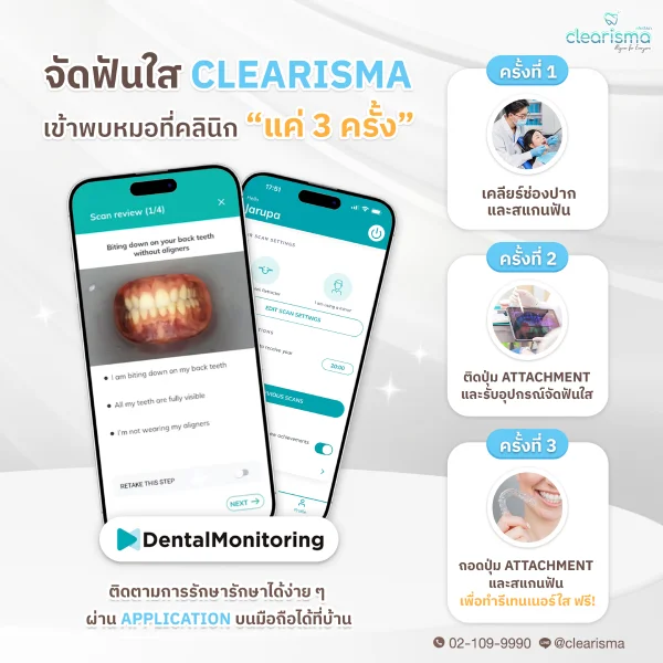 เข้าคลินิกเพียงแค่ 3 ครั้ง