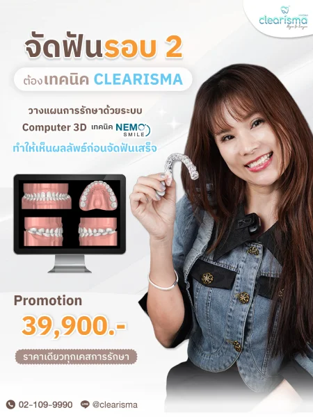โปรโมชัน จัดฟันรอบ2 คุณสิริกานต์