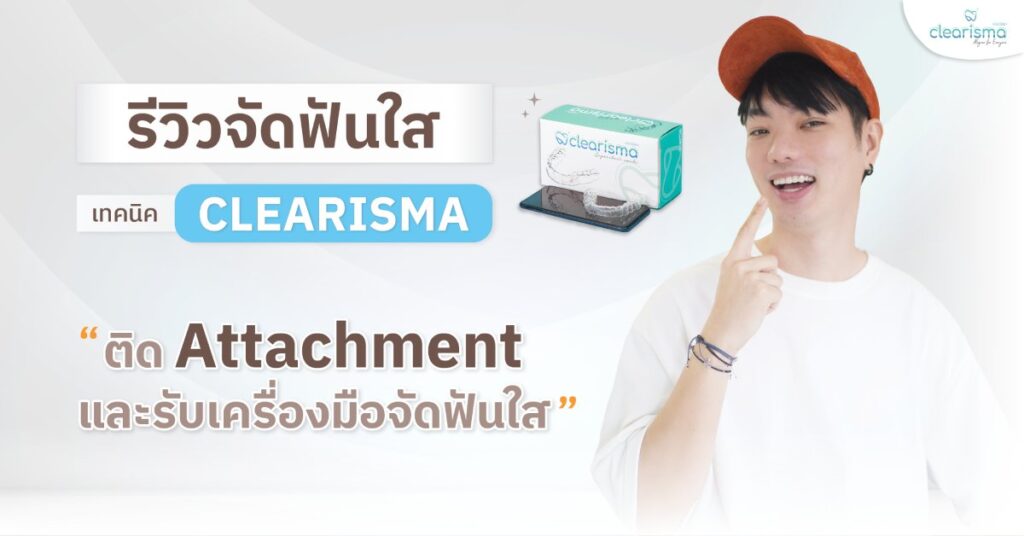รีวิวจัดฟันใส ติดAtt+รับเครื่องมือ คุณธชปาณ