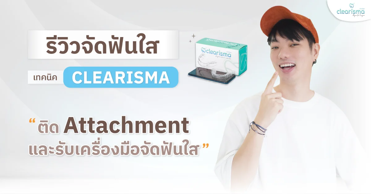 รีวิวจัดฟันใส ติดAtt+รับเครื่องมือ คุณธชปาณ