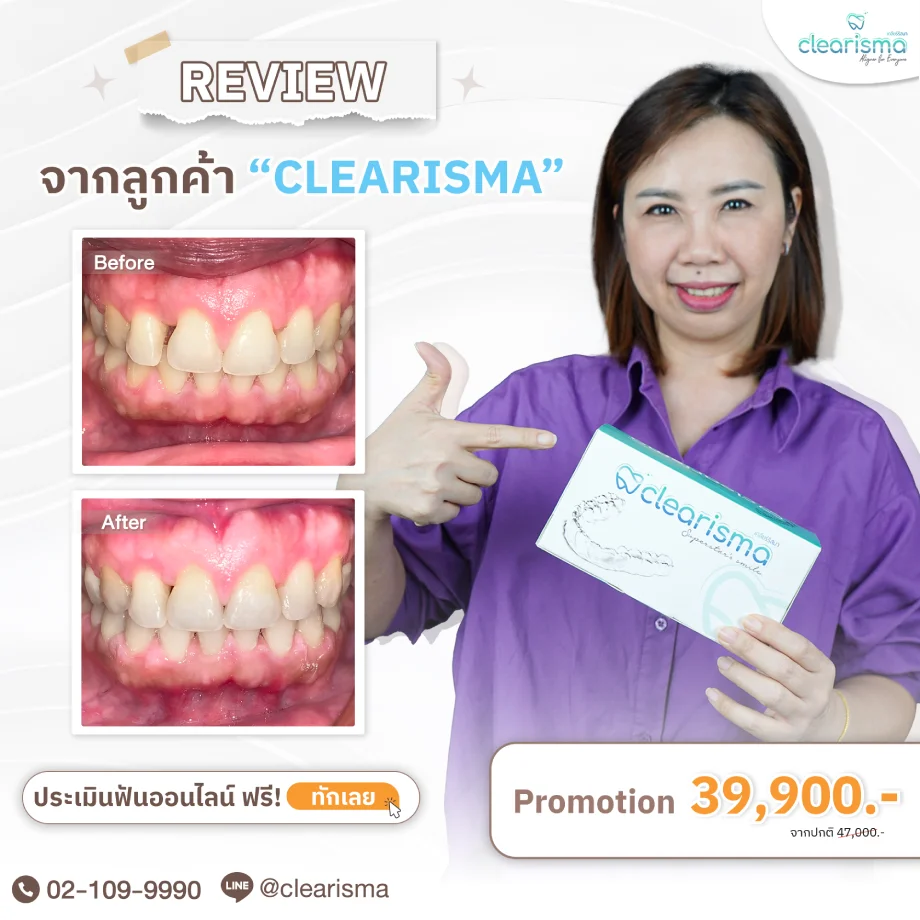 เคสรีวิว ของทางClearisma