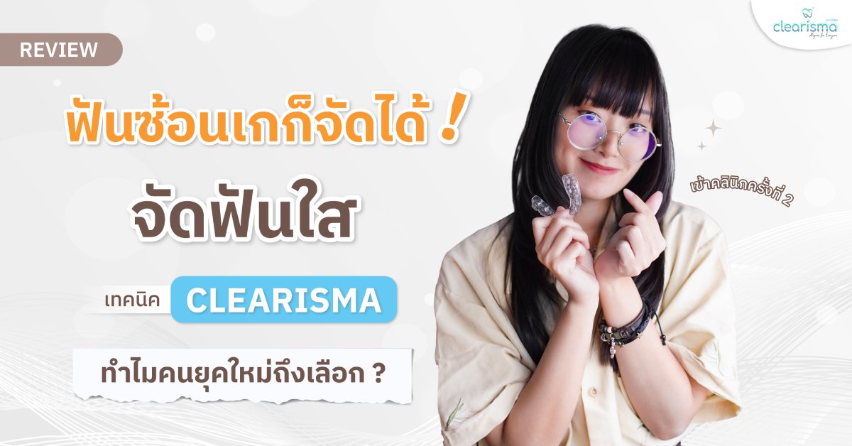 [รีวิวจัดฟันใส] ฟันซ้อนเกก็จัดได้! จัดฟันใสเทคนิค Clearisma ทำไมคนยุคใหม่ถึงเลือก