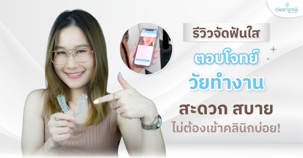 รีวิวจัดฟันใส ตอบโจทย์วัยทำงาน