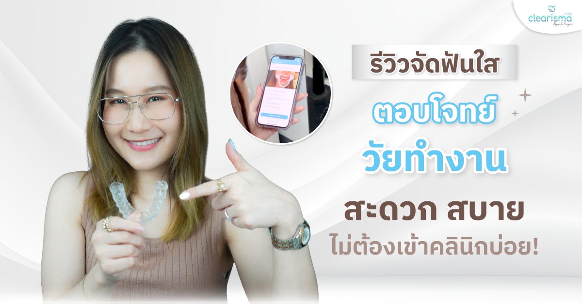 [รีวิวจัดฟันใส] ตอบโจทย์วัยทำงาน สะดวก สบาย ไม่ต้องเข้าคลินิกบ่อย!